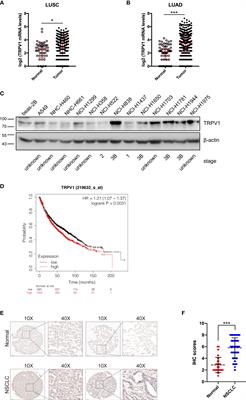 Transient Receptor Potential Cation Channel Subfamily V Member 1 Expression Promotes Chemoresistance in Non-Small-Cell Lung Cancer